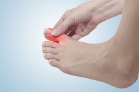 Risk Factors of Gout