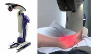 MLS Laser Therapy for Achilles Tendinitis and Plantar Fasciitis