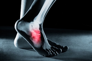Visiting a Podiatrist for Pain on the Top of the Foot
