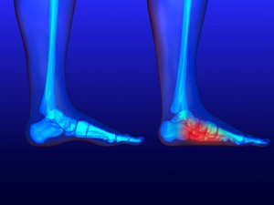 Facts and Myths About Flat Feet