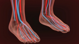 Possible Causes of Poor Circulation