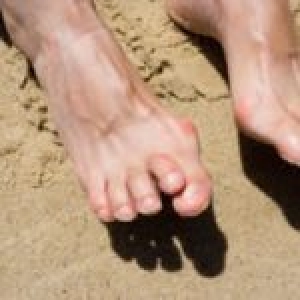 Causes of Hammertoe