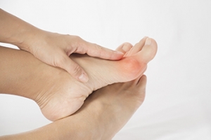 Is Bunion Surgery an Option?
