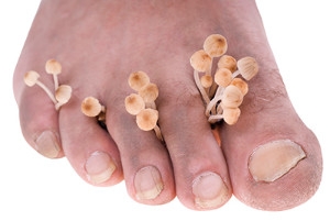 How to Avoid Toenail Fungus