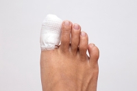 Two Types of Toe Fractures