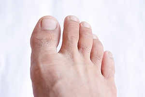 Why Does My Pinky Toe Hurt?