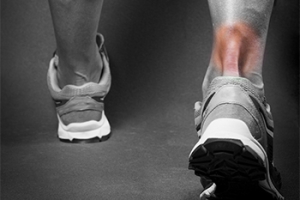 Symptoms of an Achilles Tendon Injury