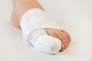 How Do Broken Toes Occur?