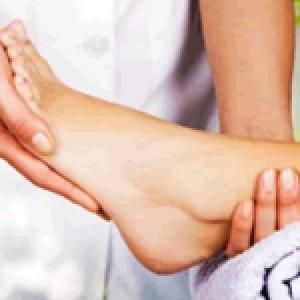Lupus in the Feet