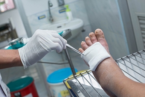 Diabetic Foot Ulcers Require Prompt Care